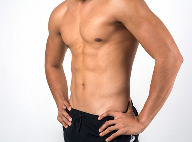 Laser Hair Removal