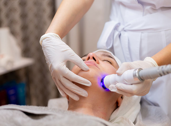 RF Skin Tightening